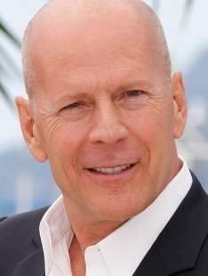 Bruce willis baldness